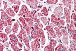 Anti-PI3 kinase C2 alpha antibody, C-term used in IHC (Paraffin sections) (IHC-P). GTX89716