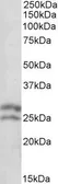 Anti-Bcl-2 antibody, N-term used in Western Blot (WB). GTX89719