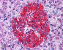 Anti-Annexin A10 antibody, N-term used in IHC (Paraffin sections) (IHC-P). GTX89720