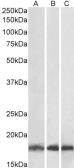 Anti-UBE2L3 antibody, C-term used in Western Blot (WB). GTX89721