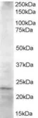 Anti-HIP2 antibody, C-term used in Western Blot (WB). GTX89722