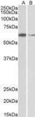 Anti-ARIH2 antibody, C-term used in Western Blot (WB). GTX89734