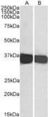 Anti-GAPDH antibody, C-term used in Western Blot (WB). GTX89740