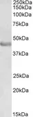 Anti-PAX3 antibody, N-term used in Western Blot (WB). GTX89743