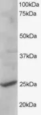 Anti-CYB561D2 antibody, C-term used in Western Blot (WB). GTX89745