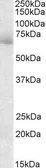 Anti-AKAP10 antibody, C-term used in Western Blot (WB). GTX89747