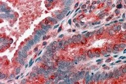 Anti-ACTR1B antibody, C-term used in IHC (Paraffin sections) (IHC-P). GTX89761