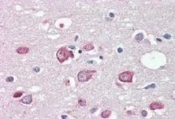 Anti-MLL4 antibody, C-term used in IHC (Paraffin sections) (IHC-P). GTX89763