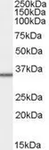 Anti-MRPL3 antibody, C-term used in Western Blot (WB). GTX89768