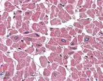 Anti-BPOZ antibody, C-term used in IHC (Paraffin sections) (IHC-P). GTX89774