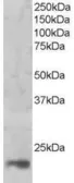 Anti-MAGOH antibody, C-term used in Western Blot (WB). GTX89780