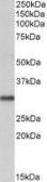 Anti-VDAC2 antibody, C-term used in Western Blot (WB). GTX89782