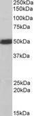 Anti-CSK antibody, C-term used in Western Blot (WB). GTX89784