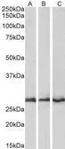 Anti-CAPZB antibody, C-term used in Western Blot (WB). GTX89785