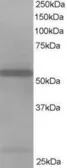 Anti-HIP55 antibody, N-term used in Western Blot (WB). GTX89787