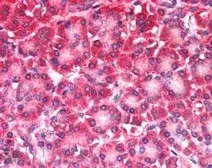 Anti-CARD6 antibody, N-term used in IHC (Paraffin sections) (IHC-P). GTX89808