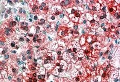 Anti-AXIN1 antibody, C-term used in IHC (Paraffin sections) (IHC-P). GTX89836
