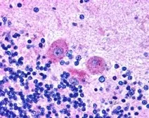 Anti-SNX26 / TCGAP antibody, C-term used in IHC (Paraffin sections) (IHC-P). GTX89840
