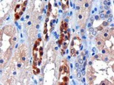 Anti-CBR1 antibody, C-term used in IHC (Paraffin sections) (IHC-P). GTX89841