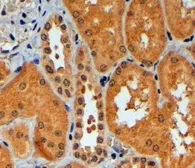 Anti-TRIM11 antibody, C-term used in IHC (Paraffin sections) (IHC-P). GTX89844