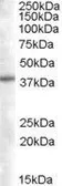 Anti-SNX16 antibody, N-term used in Western Blot (WB). GTX89846