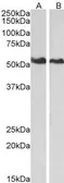 Anti-Annexin XI antibody, N-term used in Western Blot (WB). GTX89851