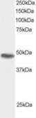 Anti-SNX15 antibody, C-term used in Western Blot (WB). GTX89856
