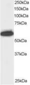 Anti-NUP50 antibody, C-term used in Western Blot (WB). GTX89862