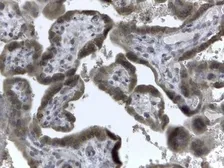 Anti-EVC2 antibody, C-term used in IHC (Paraffin sections) (IHC-P). GTX89863