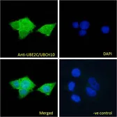 Anti-UBE2C antibody, C-term used in Immunocytochemistry/ Immunofluorescence (ICC/IF). GTX89866