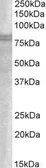 Anti-SNX18 antibody, C-term used in Western Blot (WB). GTX89870