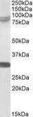 Anti-TRIM2 antibody, C-term used in Western Blot (WB). GTX89871