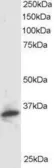 Anti-PSMF1 (Isoform 1) antibody, C-term used in Western Blot (WB). GTX89875