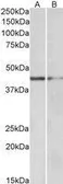 Anti-GATA3 antibody, N-term used in Western Blot (WB). GTX89886
