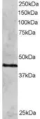 Anti-Rad51C antibody, N-term used in Western Blot (WB). GTX89889