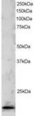 Anti-TLP antibody, C-term used in Western Blot (WB). GTX89890