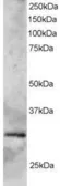 Anti-GCIP interacting protein p29 antibody, C-term used in Western Blot (WB). GTX89891
