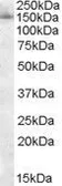 Anti-SAP130 antibody, C-term used in Western Blot (WB). GTX89893