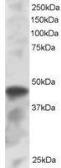 Anti-IRF8 antibody, C-term used in Western Blot (WB). GTX89895