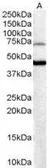 Anti-FOXG1 antibody, C-term used in Western Blot (WB). GTX89897