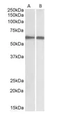 Anti-IRF5 antibody, C-term used in Western Blot (WB). GTX89902