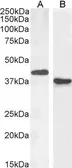 Anti-PAX5 antibody, N-term used in Western Blot (WB). GTX89903
