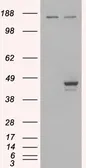 Anti-ESE1 antibody, C-term used in Western Blot (WB). GTX89904