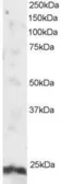 Anti-ARL4A antibody, N-term used in Western Blot (WB). GTX89910