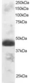 Anti-TFEC antibody, N-term used in Western Blot (WB). GTX89915