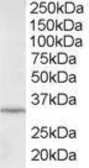 Anti-ING2 antibody, C-term used in Western Blot (WB). GTX89918