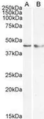 Anti-KLF15 antibody, N-term used in Western Blot (WB). GTX89919