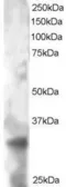 Anti-PHEMX antibody, C-term used in Western Blot (WB). GTX89920