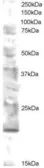 Anti-MMS2 antibody, N-term used in Western Blot (WB). GTX89925
