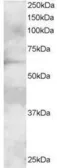 Anti-GRB7 antibody, N-term used in Western Blot (WB). GTX89926